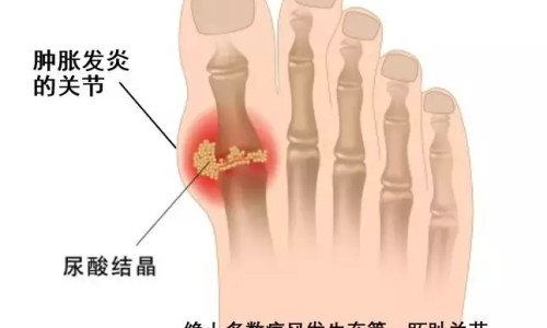 白血病柔红霉素几天-白血病用柔红霉素价格网 - 红霉素治疗白血病效果怎么样,红霉素治疗白血病效果怎么样